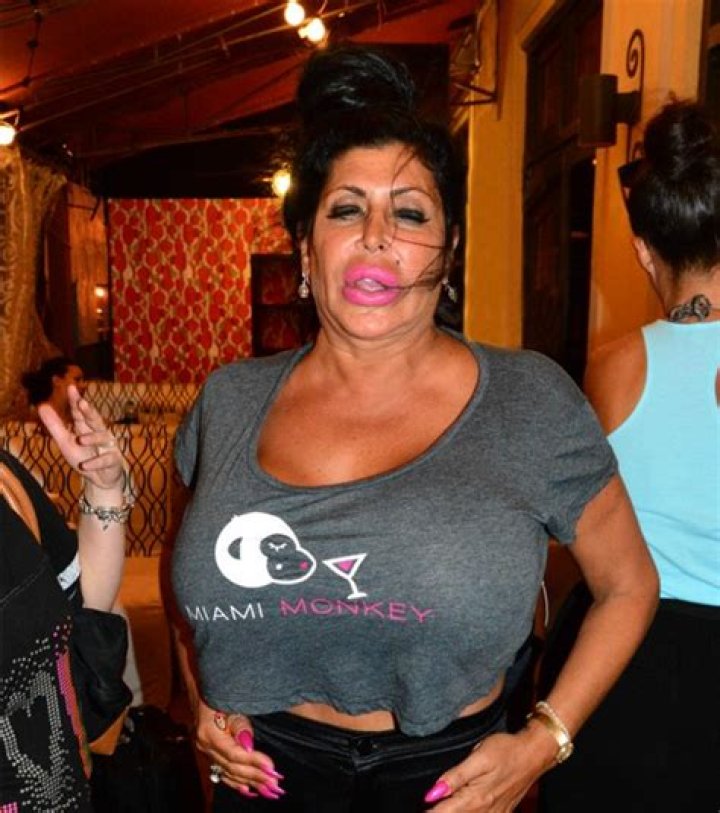 Mob Wives Star Big Ang Has Massive Throat Tumor – Admitted For Surgery